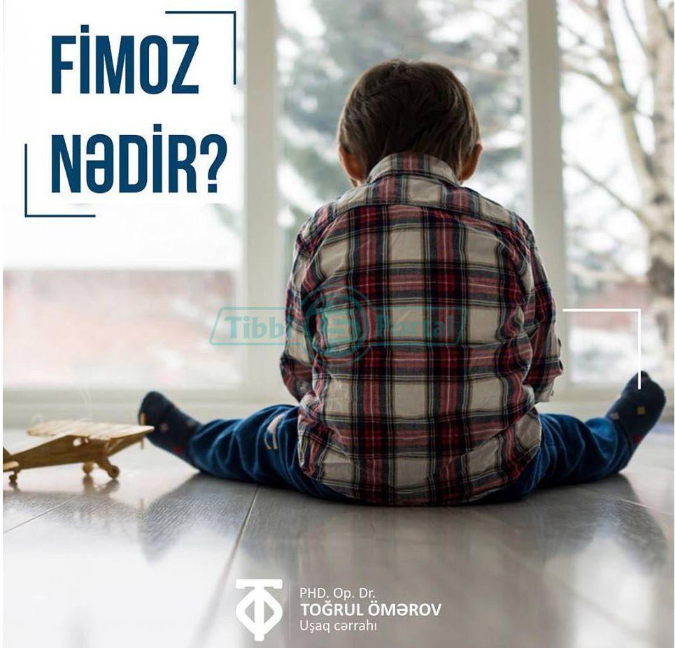 Fimoz nədir?