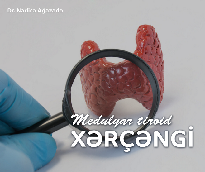 Medulyar tiroid xərçəngi