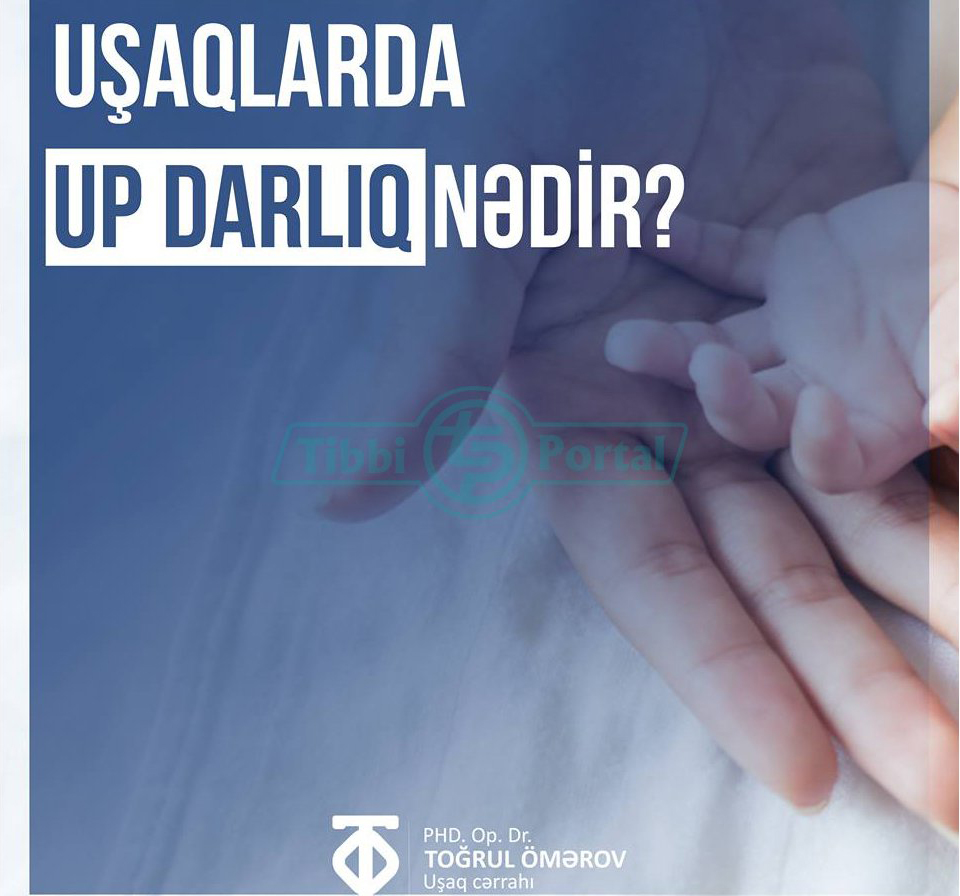 Uşaqlarda up darlıq nədir?